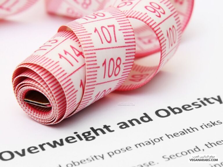 أضرار السمنة