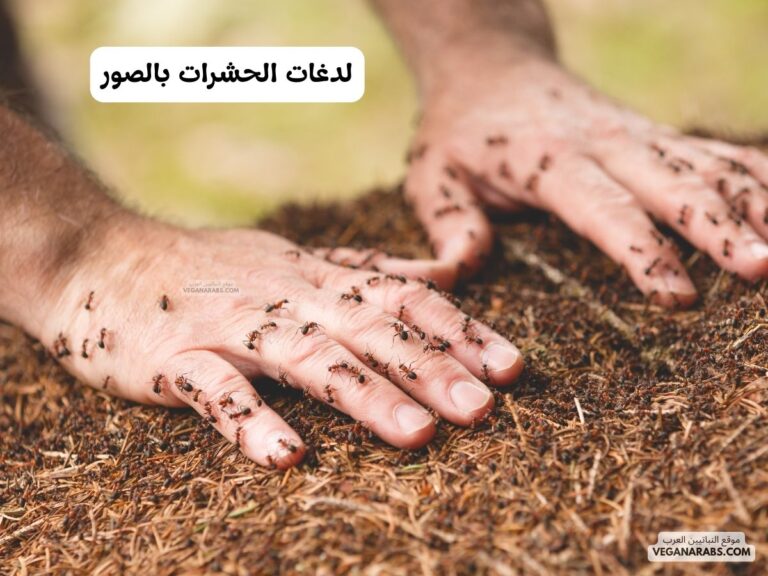 لدغات الحشرات بالصور