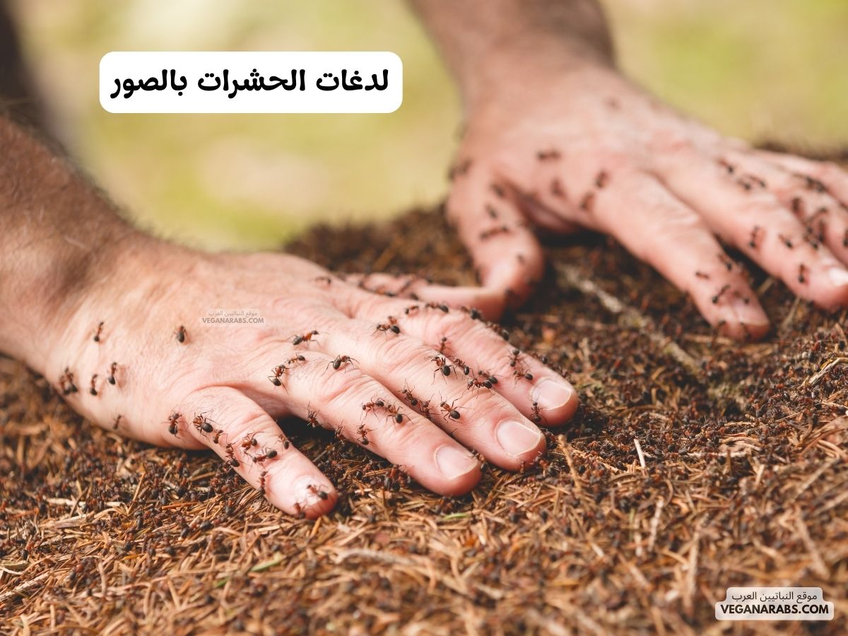 لدغات الحشرات بالصور