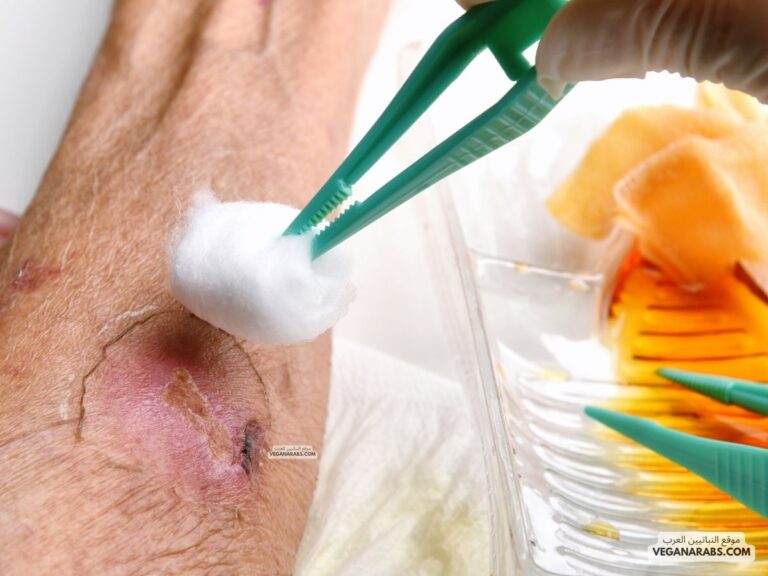 فوائد العسل للجروح