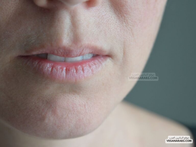 أسباب تقشر الشفاه