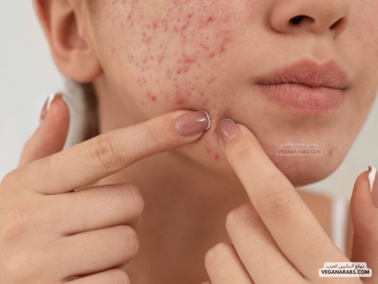طرق إزالة حبوب الوجه