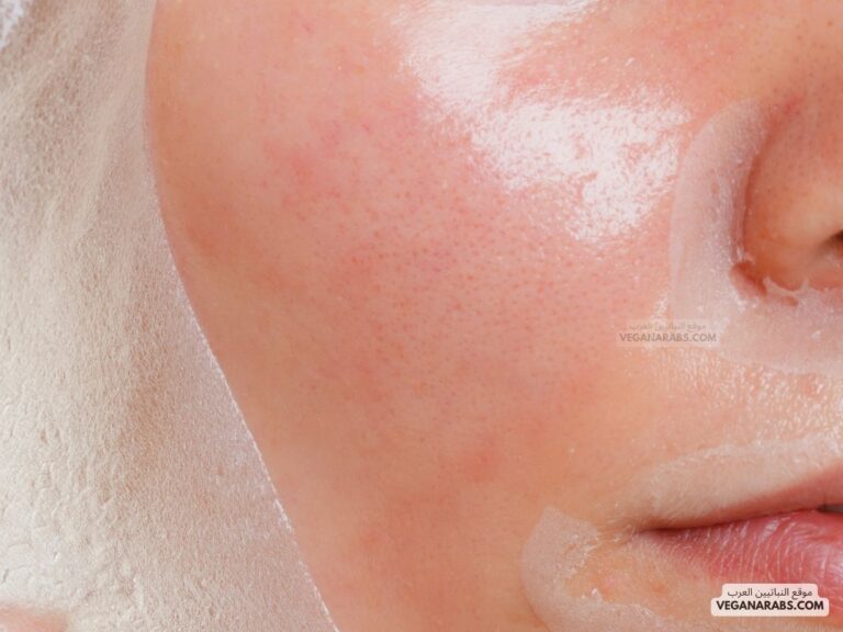 ما أسباب تقشر الوجه