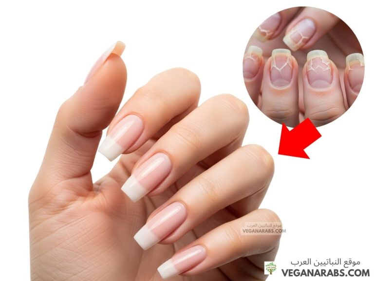 علاج ضعف الأظافر